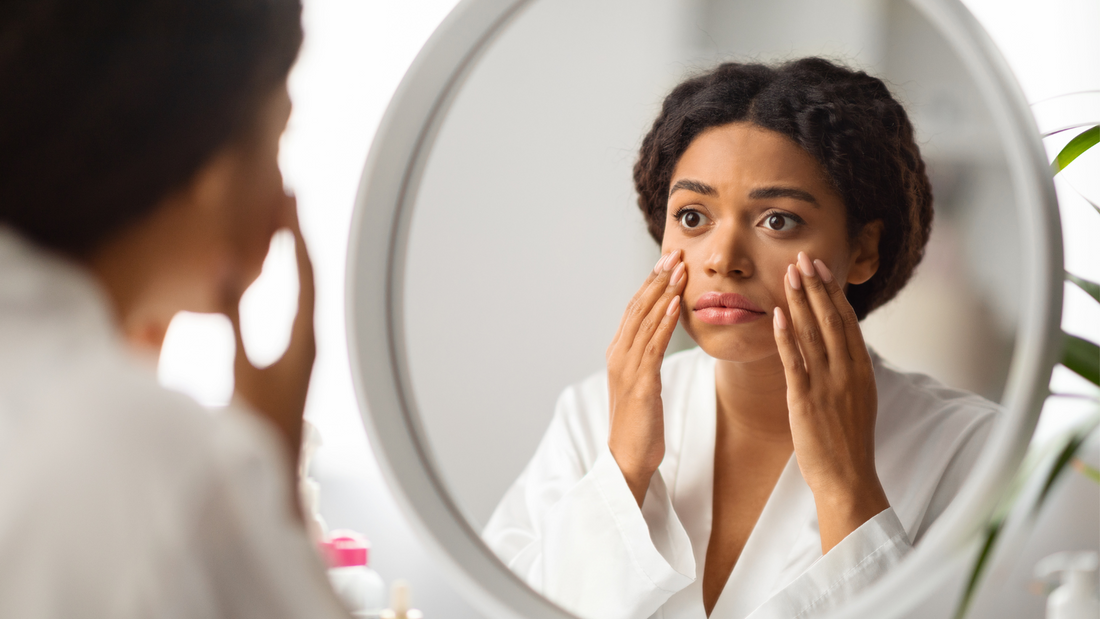 La peau, miroir de ton stress : comment le stress impacte ton teint