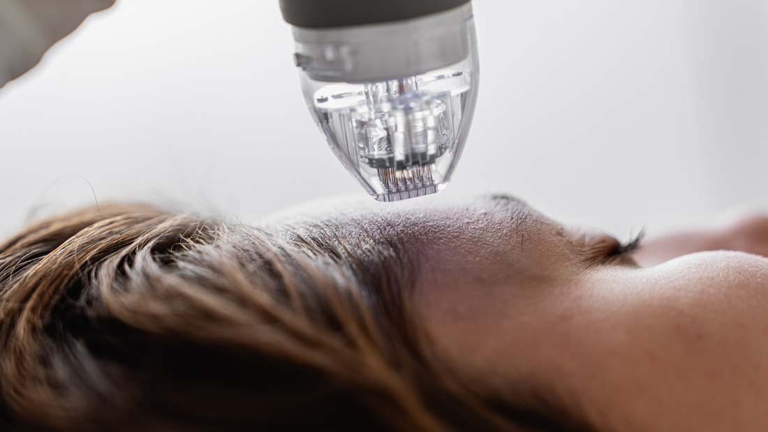 micro-cône, cosmétique transépidermique , microneedling