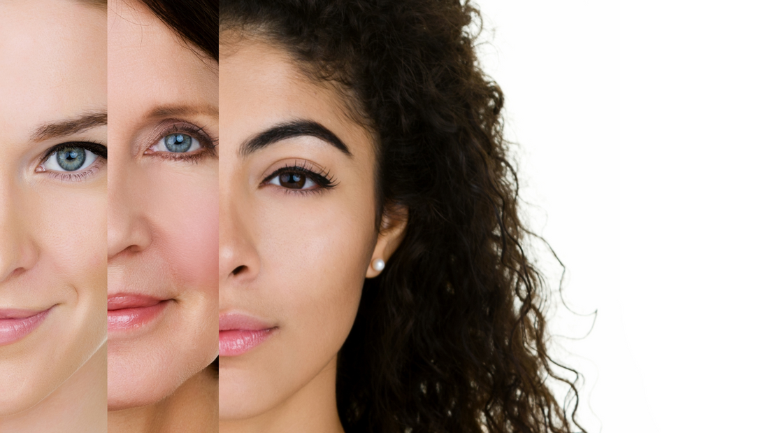 plusieurs femmes au types de peau différents