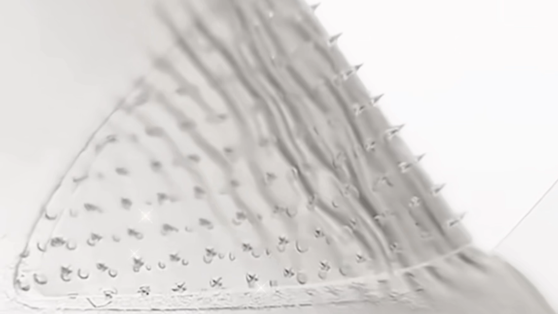 patchs microstructure ou injections