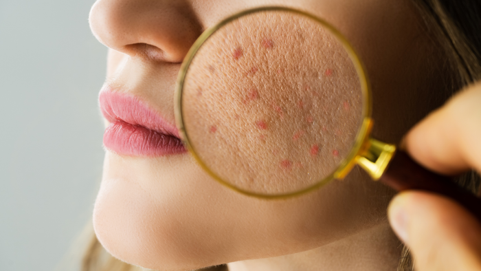 Why Your Skin Needs a Strong Skin Barrier to Stay Youthful