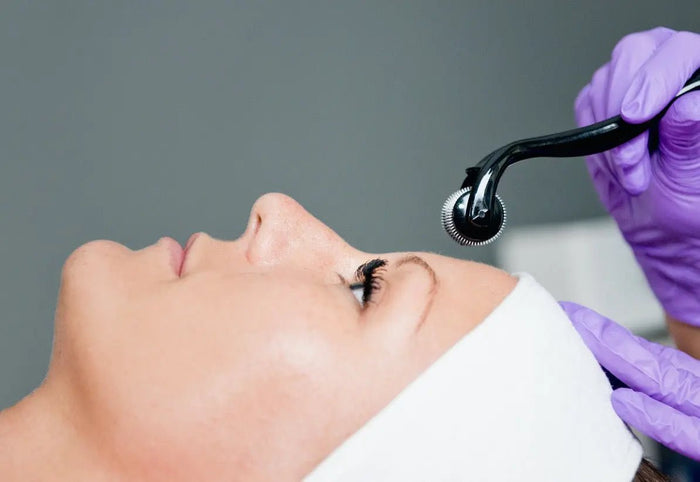 Microneedling 101 : Le traitement polyvalent qui révolutionne l'industrie de la beauté
