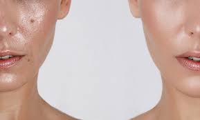 Routine Peau Grasse: 10 Étapes Pour une Peau Parfaite