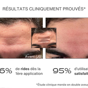 Avant / Après pour le patch anti-rides - résultats cliniquement prouvés