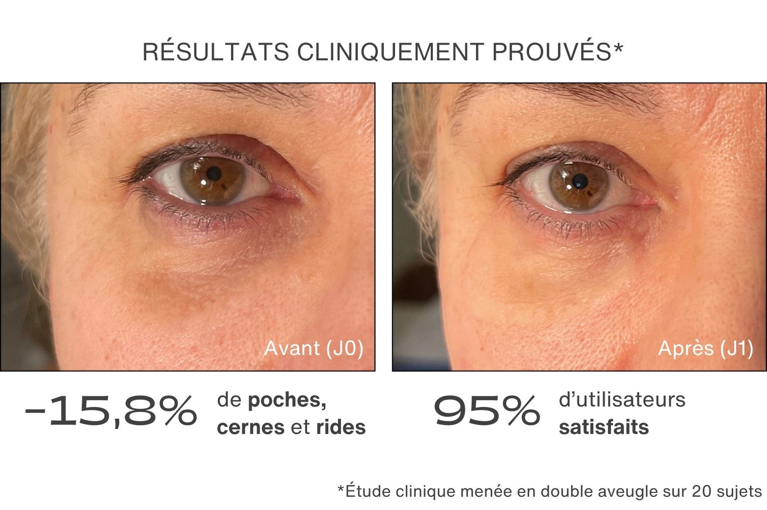 Avant / Après pour le patch contour des yeux - résultats cliniquement prouvés