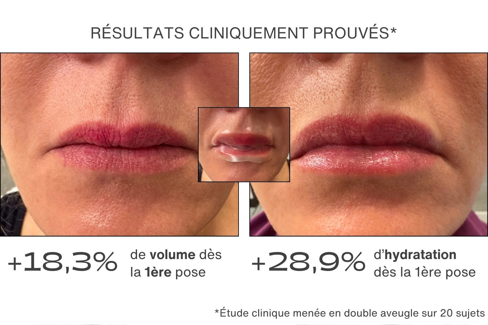 Avant / Après pour le patch lèvres - résultats cliniquement prouvés